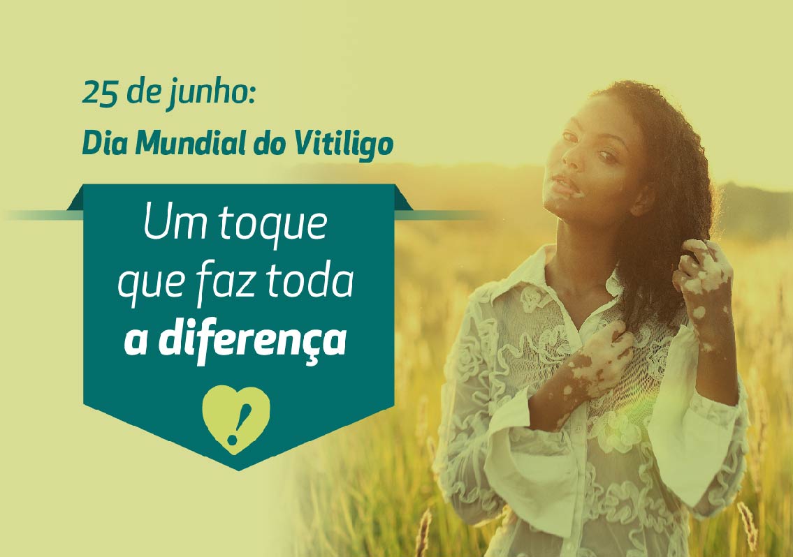 25junhodiadovitiligo.jpg
