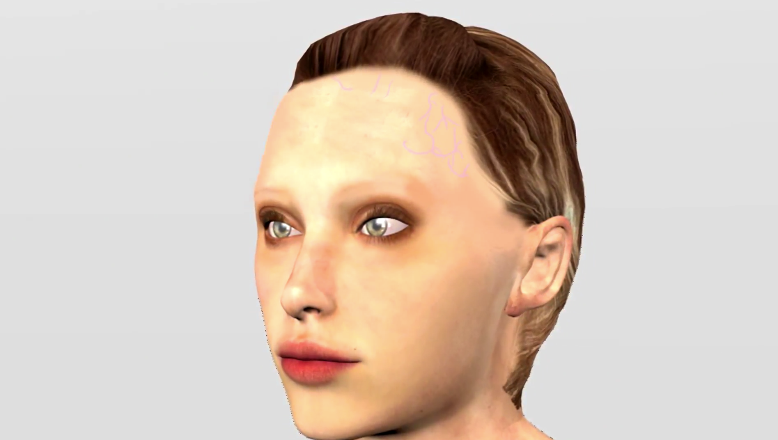 alopeciafrontalfibrosante.png