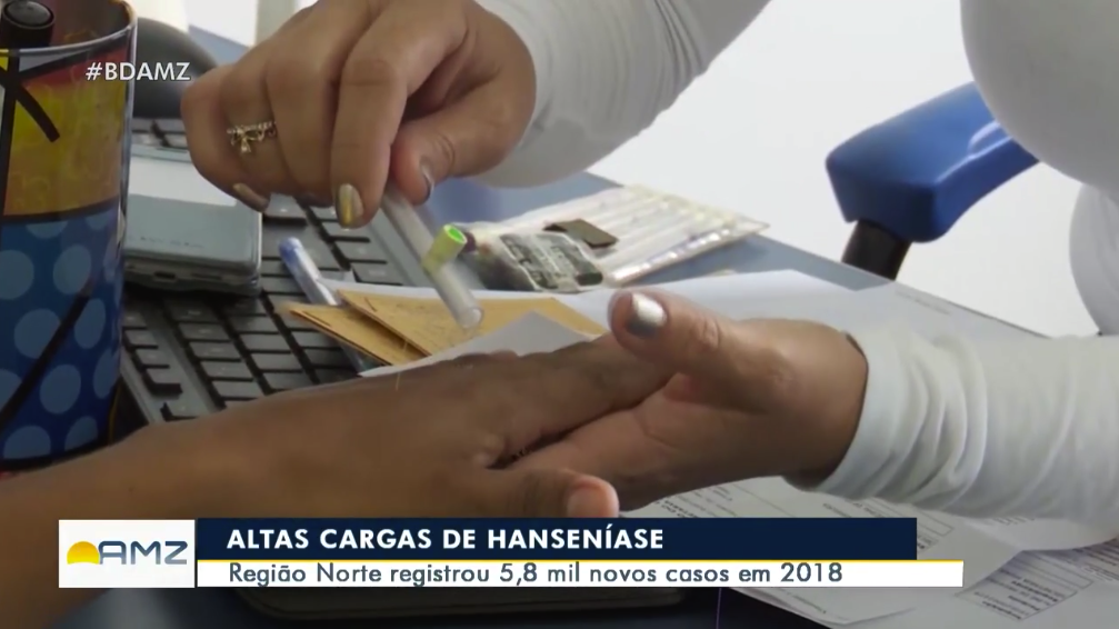 regiao-norte-hanse.png