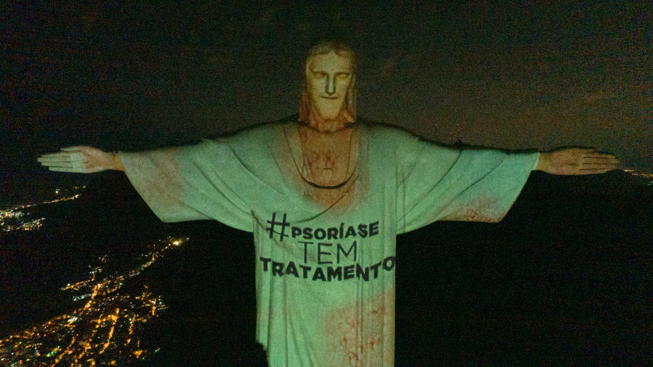 psoriase-tem-tratamento---cristo-1.jpeg