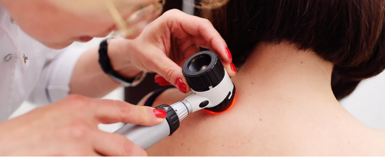 dermatoscopia---bakos.png