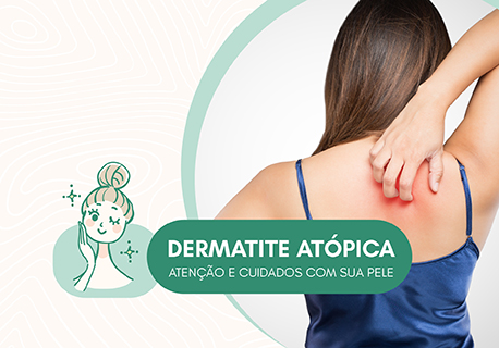 sitenoticia-dermatiteatopica-03.jpg