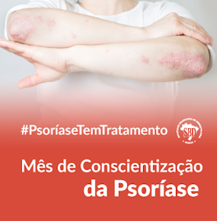 psoriase2020acoesdestaque-menor_317x323.png